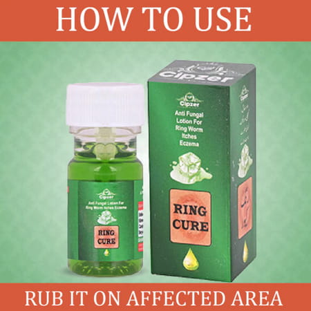 Cipzer Ring Cure Lotion 30ml | Supports Skin Health & Provides Relief From Ringworm & Itching