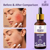 Newish Lavender Essential Oil For Hair Skin & Diffuser 30Ml