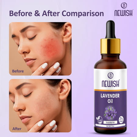 Newish Lavender Essential Oil For Hair Skin & Diffuser 30Ml
