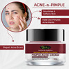 Pimple Acne Herbal Cream For Pimples And Dark Spots | Pure Ayurvedic Cream 100% Ayurvedic (50gm)