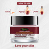 Pimple Acne Herbal Cream For Pimples And Dark Spots | Pure Ayurvedic Cream 100% Ayurvedic (50gm)