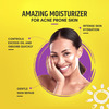 Brinton Acmist Vitamin E & Aloe Vera Based Moisturizing Cream Gel For Acne Prone & Oily Skin 50g X 2