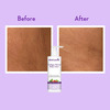 Wishcare Collagen 1% Retinol Body Lotion - Skin Tightening & Firming | Niacinamide & Rosehip (200Ml)