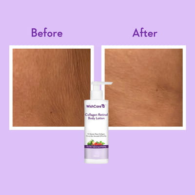 View product image 3