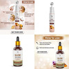 Tnw-The Natural Wash Skincare Combo With Glow Face Serum And Under Eye Cream