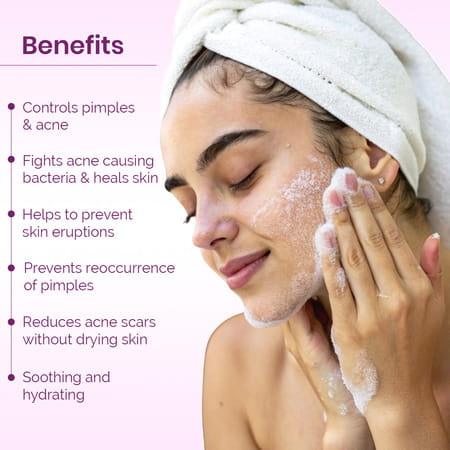 Acnedew Anti Acne & Anti Pimple Soap With Aloe & Tea Tree Oil (100 Gm Pack Of 1)