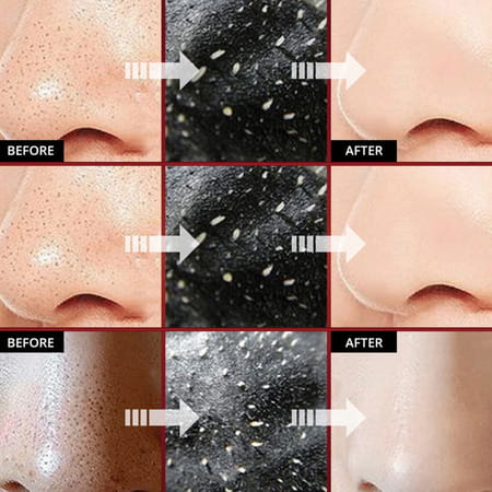 Mancode Charcoal Peel Off Mask 100Gm