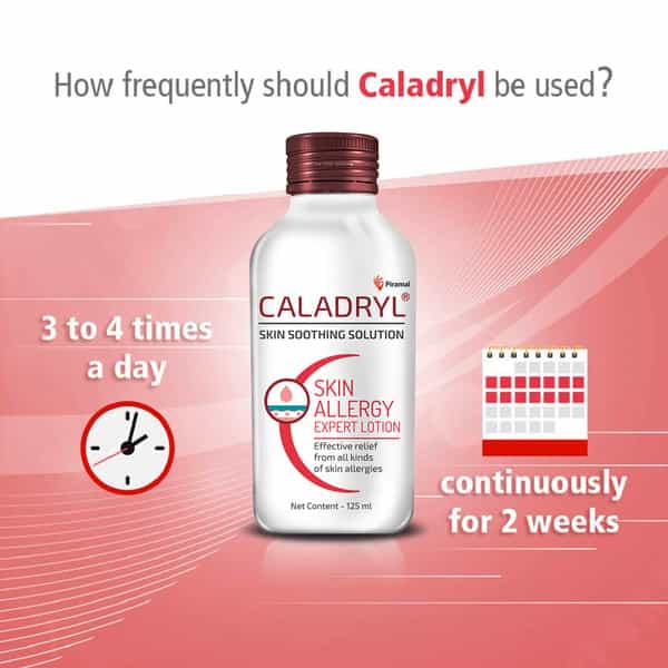 Caladryl Skin Allergy Lotion For Rashes | Sunburn | Prickly Heat And Insect Bites- 125Ml