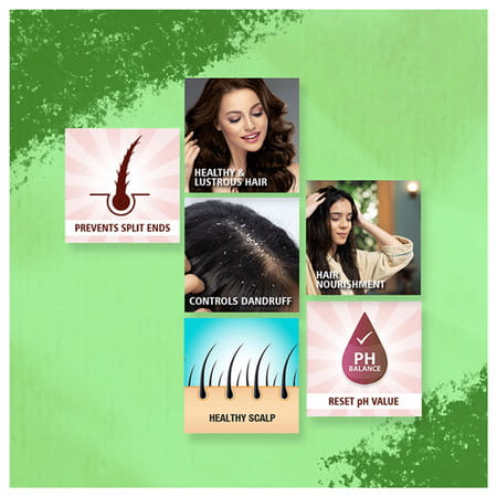 Sunny Herbals Arnica Hair Oil With Jaborandi 150 Ml