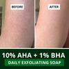 Bake 10% Aha + 1% Bha Soap For Pores | Exfoliation & Strawberry Skin (Pack Of 2)