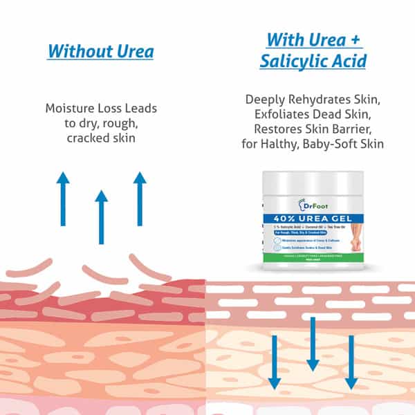 Dr Foot 40% Urea Gel With 1% Salicylic Acid Coconut Oil And Tea Tree Oil Moisturizes -100 Gm