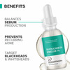 Dermatouch Salicylic Acid 2% Sebustop W/W 2% Face Serum |Specially For Acne-Prone & Oily Skin | 30Ml