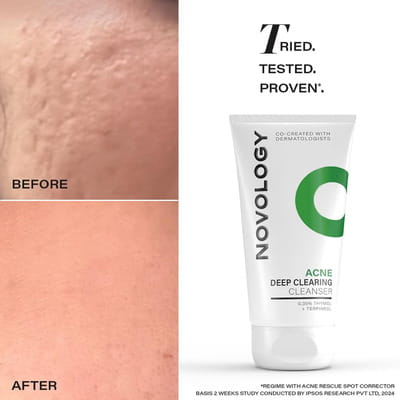 View product image 5