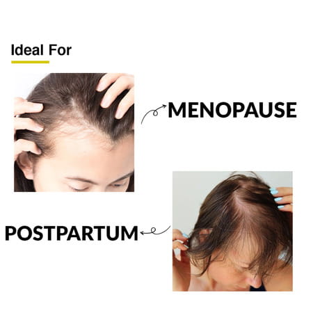 Fixderma Kairfoll Femme Specifique Shampoo For Post-Partum & Menopause | Red Onion Shampoo - 200 Ml