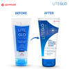 Lite Glo Face Wash Tube Of 100 Ml