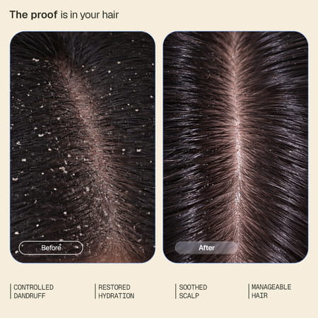Arata Anti - Dandruff Conditioner | Hydrates & Reduces Dandruff | Piroctone Olamine | 200 Ml