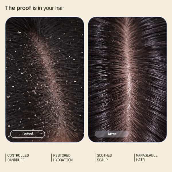 Arata Anti - Dandruff Conditioner | Hydrates & Reduces Dandruff | Piroctone Olamine | 200 Ml