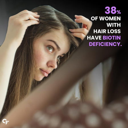 Carbamide Forte Biotin With Sasbania Grandiflora Extract Amla Extract-90 Tablets