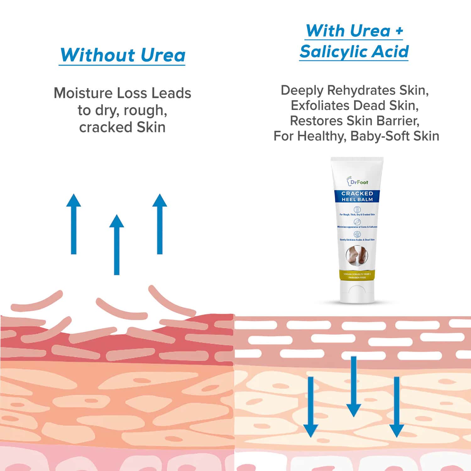 Buy DR FOOT CRACKED HEEL BALM UREA, ALOE VERA & TEA TREE OIL ROUGH