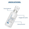Fcl B-Prox Face Wash For Acne Prone Skin And Gently Removes The Dead Skin
