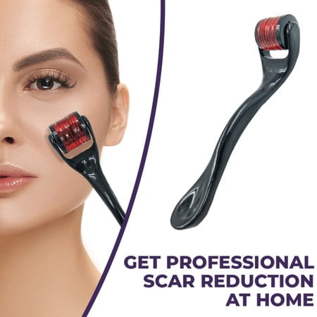 Sanfe Selfly Derma Roller - 0.5mm 540 Titanium Alloy Micro Needles Hair & Beard Follicle Stimulation