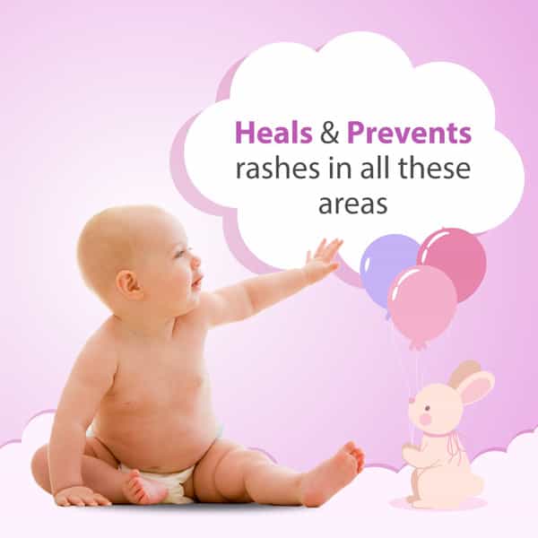 Pearldew Baby Diaper Rash Cream 50 Gm | With Calendula & Witch Hazel (Pack Of 2)