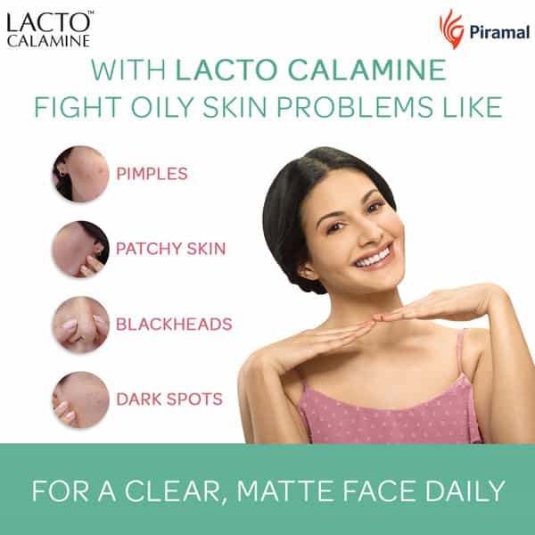 Lacto Calamine Oil Balance Daily Face Care Lotion - Aloe Vera -120Ml (Pack Of 2)
