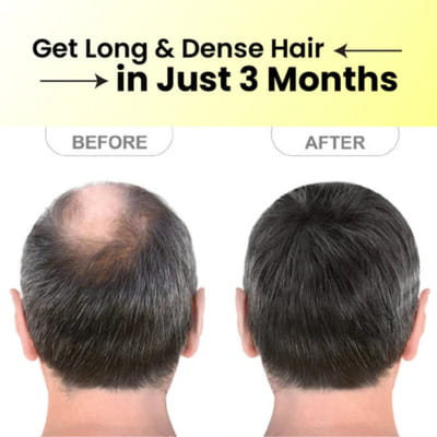View product image 2