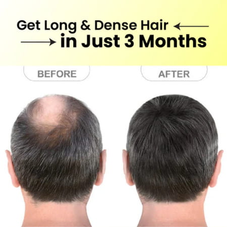 Cipzer Hair & Handsome Oil | Promotes Hair Growth & Strengthens Hair | 100 Ml (Pack Of 1)