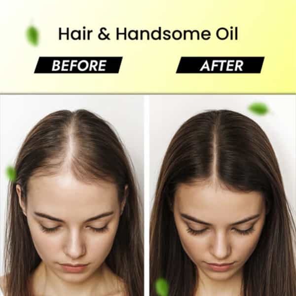 Cipzer Hair & Handsome Oil | Promotes Hair Growth & Strengthens Hair | 100 Ml (Pack Of 1)