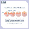 Gubb Derma Roller 0.5Mm For Hair Regrowth Face Acne Scars & Skin Aging 540 Micro Needles - Pink