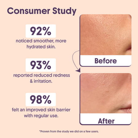 Aravi Organic Advanced Barrier Repair Moisturizer - 100gm