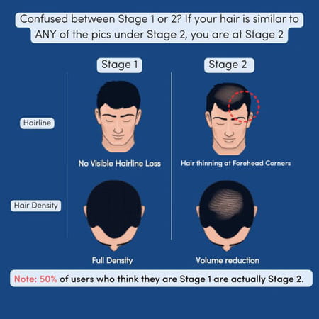 Man Matters Nourish Hair Gummies 60n