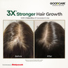 Goodcare Root Boost Hair Oil Hibiscus | Men Women | Hair Growth | 100 Ml | Pack Of 1
