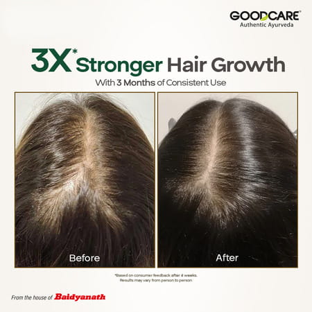 Goodcare Root Boost Hair Oil Hibiscus | Men Women | Hair Growth | 100 Ml | Pack Of 1