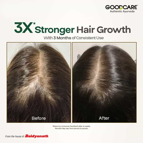 Goodcare Root Boost Hair Oil Hibiscus | Men Women | Hair Growth | 100 Ml | Pack Of 1