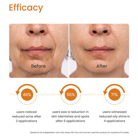 Earth Rhythm Clear Skin - Ultimate 20% Vitamin C Glow Serum - 30 Ml