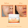 Wishcare Vitamin C Pure Glow Face Cream For Women & Men - With Hyaluronic Acid | Niacinamidec 50 Gm