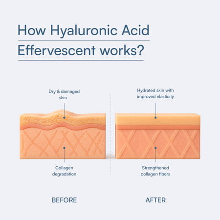 Hk Vitals Hyaluronic Acid (Orange | 15 Effervescent Tablets) | 500mg Hyaluronic Acid