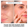 Cos-Iq Vitamin C-8% Face Serum 30Ml | Only 2 Ingredients | Safe And Effective