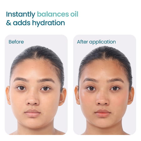 Wishcare Niacinamide Water Gel Moisturizer - Oily & Combination Skin - 50Ml