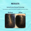 Dermistry Anti Hair Fall Control Serum Follicusan Hairgenyl Caffeine For Strengthening Roots 50Ml