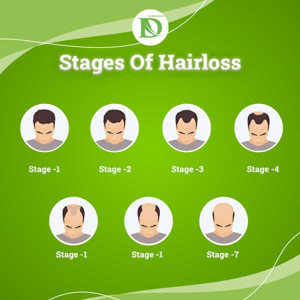 Dr Nagwani Minoxidil 5% & Finasteride 0.1% | Hair Growth F Hair Solution | 60 Ml