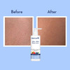 Wishcare 10% Aha + 1% Bha Body Lotion - Smooths Rough & Bumpy Skin - Lactic Acid Body Lotion (200Ml)
