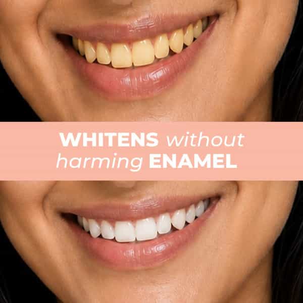 Peach Mint Teeth Whitening| Toothpaste For Sensitivity & Cavity| 5% Hap + Nhap| Fluoride Free| 100G