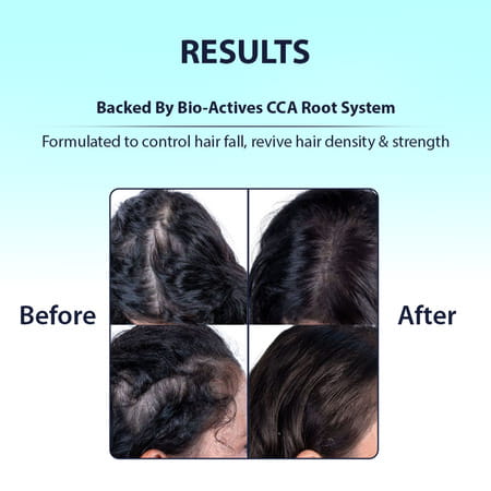 Dermistry Anti Hair Fall Control & Repair Mask With Collagen Arginine For Strengthening Roots 200ml