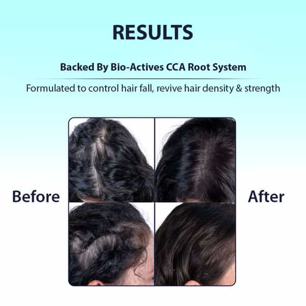 Dermistry Anti Hair Fall Control & Repair Mask With Collagen Arginine For Strengthening Roots 200Ml