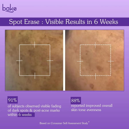 Bake Spot Erase Dark Spot Correcting Cream For Acne Marks & Pigmentation (30G)