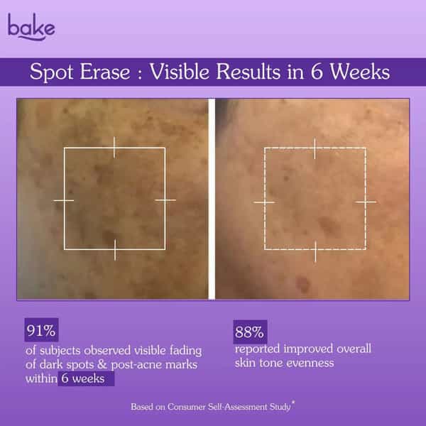 Bake Spot Erase Dark Spot Correcting Cream For Acne Marks & Pigmentation (30G)