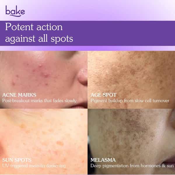 Bake Spot Erase Dark Spot Correcting Cream For Acne Marks & Pigmentation (30G)